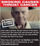 Australia 2012 Health Effects Other - throat cancer lived experience back
