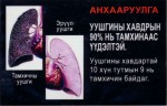 Mongolia 2014 Health Effects lung - diseased organ