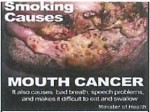 Suriname 2014 - Health Effects mouth - cancer (back)