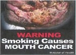 Suriname 2014 - Health Effects mouth - cancer (front)