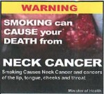Suriname 2014 - Health Effects other - neck cancer (back)