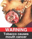 India 2015 Health Effects Mouth - mouth cancer, gross jaw