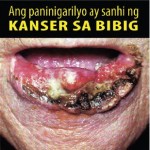 Philippines 2014 Health Effects Mouth - mouth cancer, gross (Filipino)