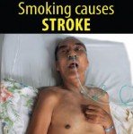 Philippines 2014 Health Effects Stroke - lived experience (English)