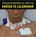 Philippines 2014 Health Effects other - throat cancer, lived experience (Filipino)