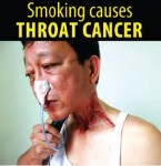 Philippines 2014 Health Effects other - throat cancer2, lived experience (English)