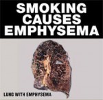 Australia 2012 Health Effects Lung - emphysema front