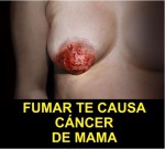 Ecuador 2014 Health Effects other - breast cancer