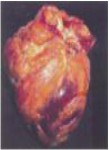 2013 Fiji Health Effect heart - heart attack, diseased heart