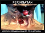 2014 Indonesia Health Effects other - throat cancer