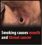EU 2016 Health Effects mouth - mouth and throat cancer, lived experience