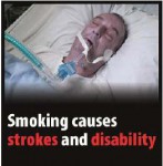 EU 2016 Health Effects stroke - stroke, disability, lived experience