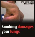 EU 2016-Set 2-Health Effects lung - lung damage, wound