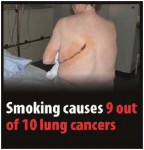 EU 2016-Set 3-Health Effects lung - lung cancer, scar
