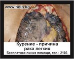 Kyrgyzstan 2016 Health Effects Lung - lung cancer