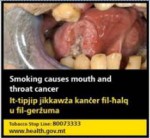 Malta 2016 Health Effects Mouth - Tongue cancer, gross - set 3