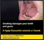 Malta 2016 Health Effects mouth - teeth, gum damage - set 3