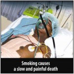 Mauritius 2009 Health Effects Death - hospitalized, lived experience_EN