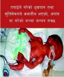Nepal 2014 ETS Baby - premature birth (bidi)