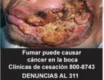 Panama 2015 Health Effects Mouth - mouth cancer