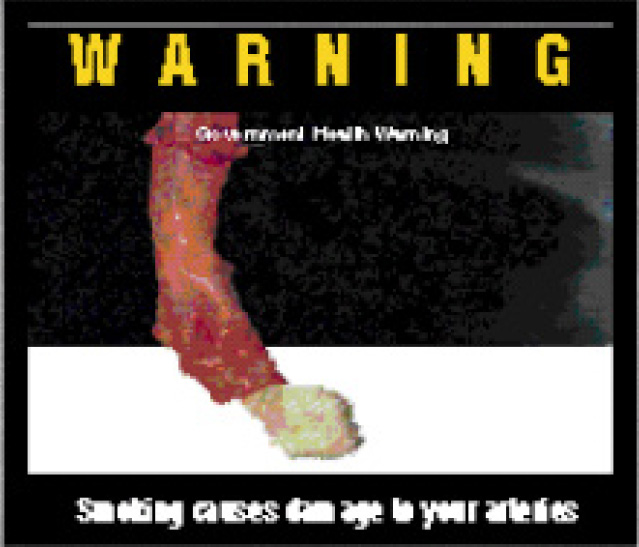 Aussie 2001 Health Effects arteries - diseased organ, clogged arteries, gross