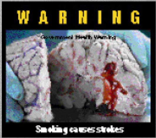 Aussie 2001 Health Effects stroke - diseased organ, brain, stroke, gross