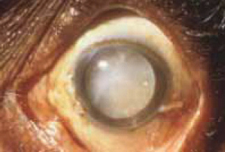 Aussie 2002 Health Effects eye - diseased organ, eye disease 1, gross