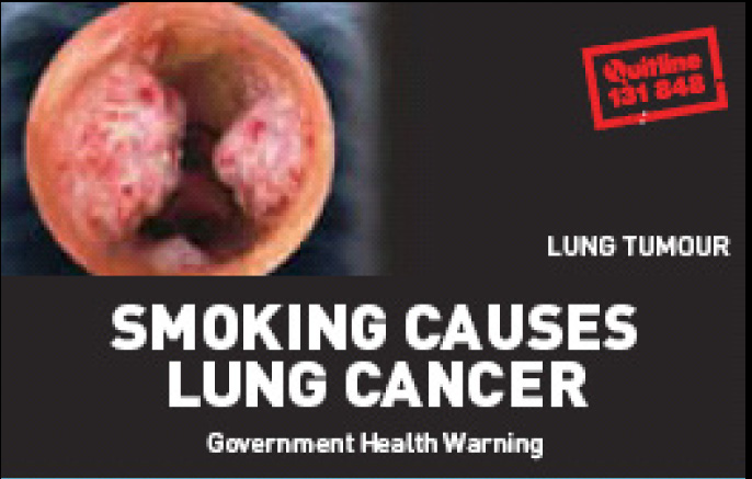 Aussie 2002 Health Effects lung - diseased organ, lung cancer, gross package front