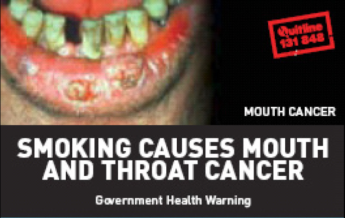 Aussie 2002 Health Effects mouth - diseased organ, mouth and throat cancer, gross