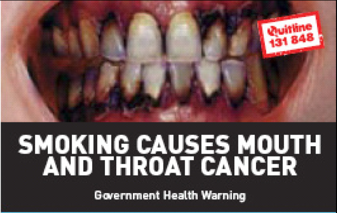 Aussie 2002 Health Effects mouth - diseased organs, mouth & throat cancer, gross