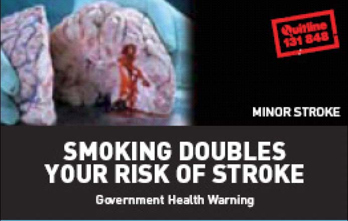 Aussie 2002 Health Effects stroke - diseased organ, brain & stroke, gross