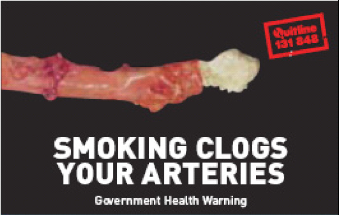 Aussie 2006 Health Effects arteries PACK - diseased organs, clogged arteries, gross