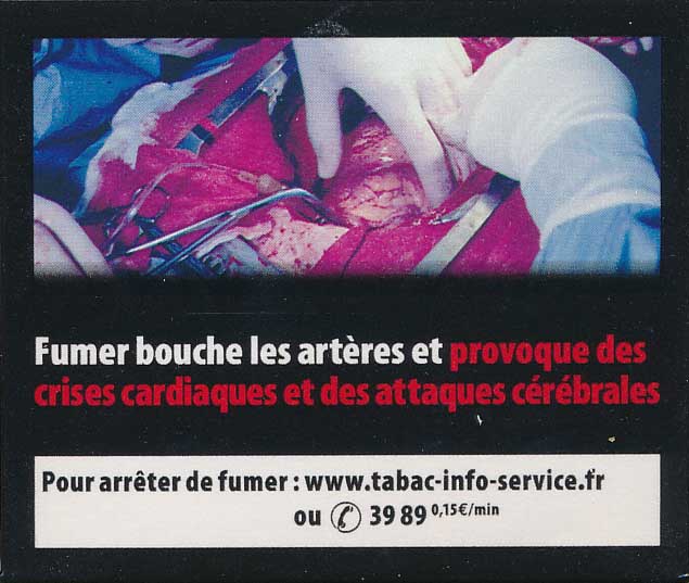 France2011bHealthEffectsArteries-livedexperience_cloggedarteries_heartattack_stroke_graphic